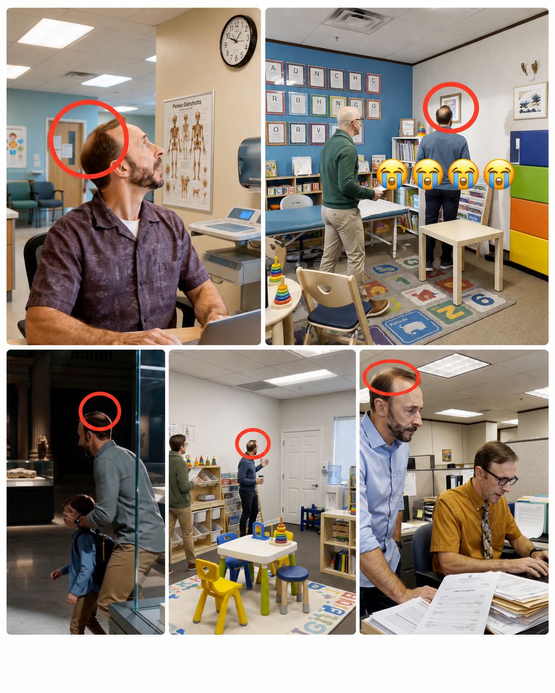 A collage of five AI-generated scenes of me in clinics and offices, each with a red circle around the back of my head showing a full head of hair that does not exist.